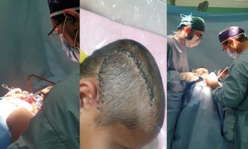 جراحی موفقیت‌آمیز خونریزی مغزی در گناباد